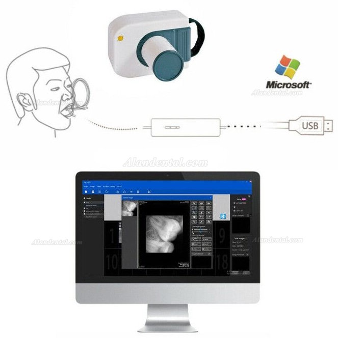 Dental RVG X-Ray Sensor Dental Intraoral Imaging System VXS2121/2530